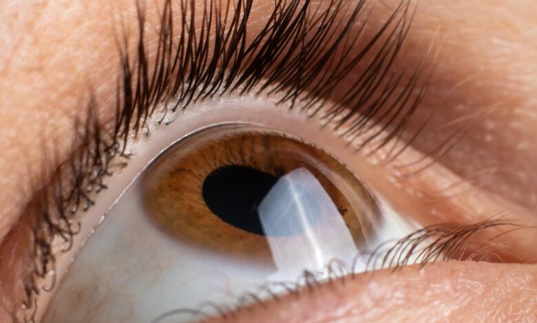 Eye donation and corneal transplant