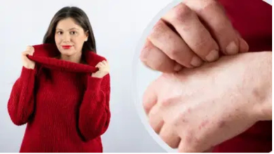 सर्दियों में ऊनी कपड़ों से बढ़ती खुजली के पीछे छुपा है एक खतरनाक राज! क्या आप जानते हैं इससे बचने के सबसे असरदार और अचूक उपाय? पढ़िए और बचिए इस चौंकाने वाली समस्या से