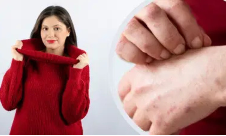 सर्दियों में ऊनी कपड़ों से बढ़ती खुजली के पीछे छुपा है एक खतरनाक राज! क्या आप जानते हैं इससे बचने के सबसे असरदार और अचूक उपाय? पढ़िए और बचिए इस चौंकाने वाली समस्या से