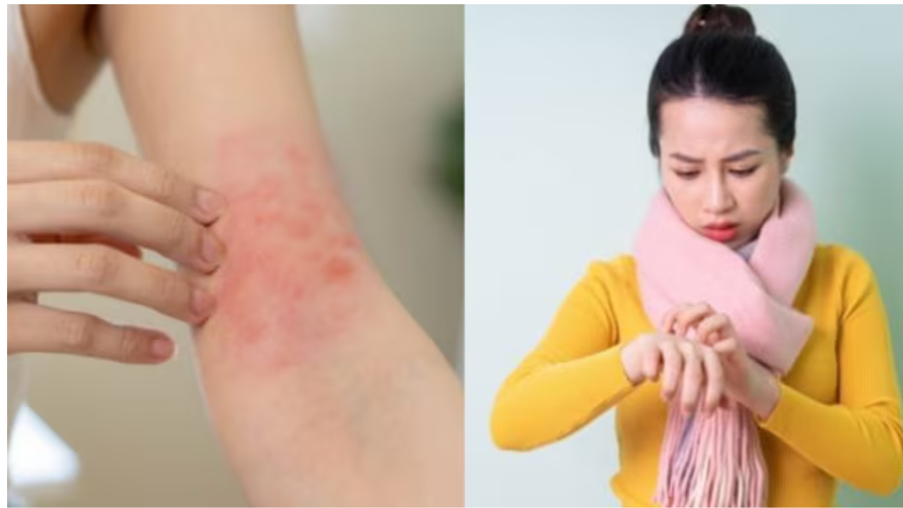 सर्दियों में ऊनी कपड़ों से बढ़ती खुजली के पीछे छुपा है एक खतरनाक राज! क्या आप जानते हैं इससे बचने के सबसे असरदार और अचूक उपाय? पढ़िए और बचिए इस चौंकाने वाली समस्या से