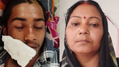 गोरखपुर में नाबालिग हमले की चार्जशीट से नाम हटाने का आरोप, SSP ने दिए जांच के आदेश