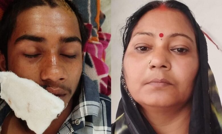 गोरखपुर में नाबालिग हमले की चार्जशीट से नाम हटाने का आरोप, SSP ने दिए जांच के आदेश